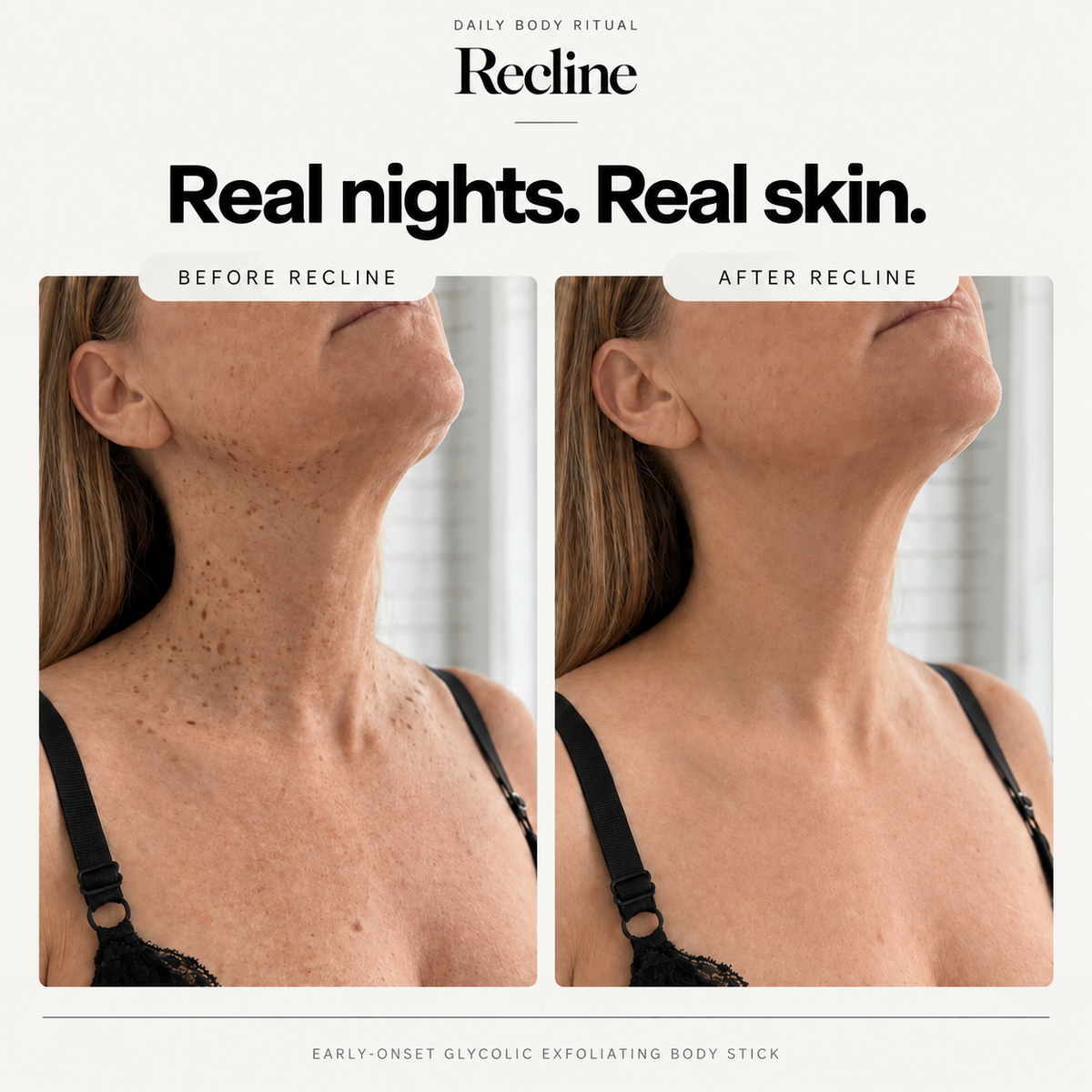 Recline Early-Onset Glycolic Stick