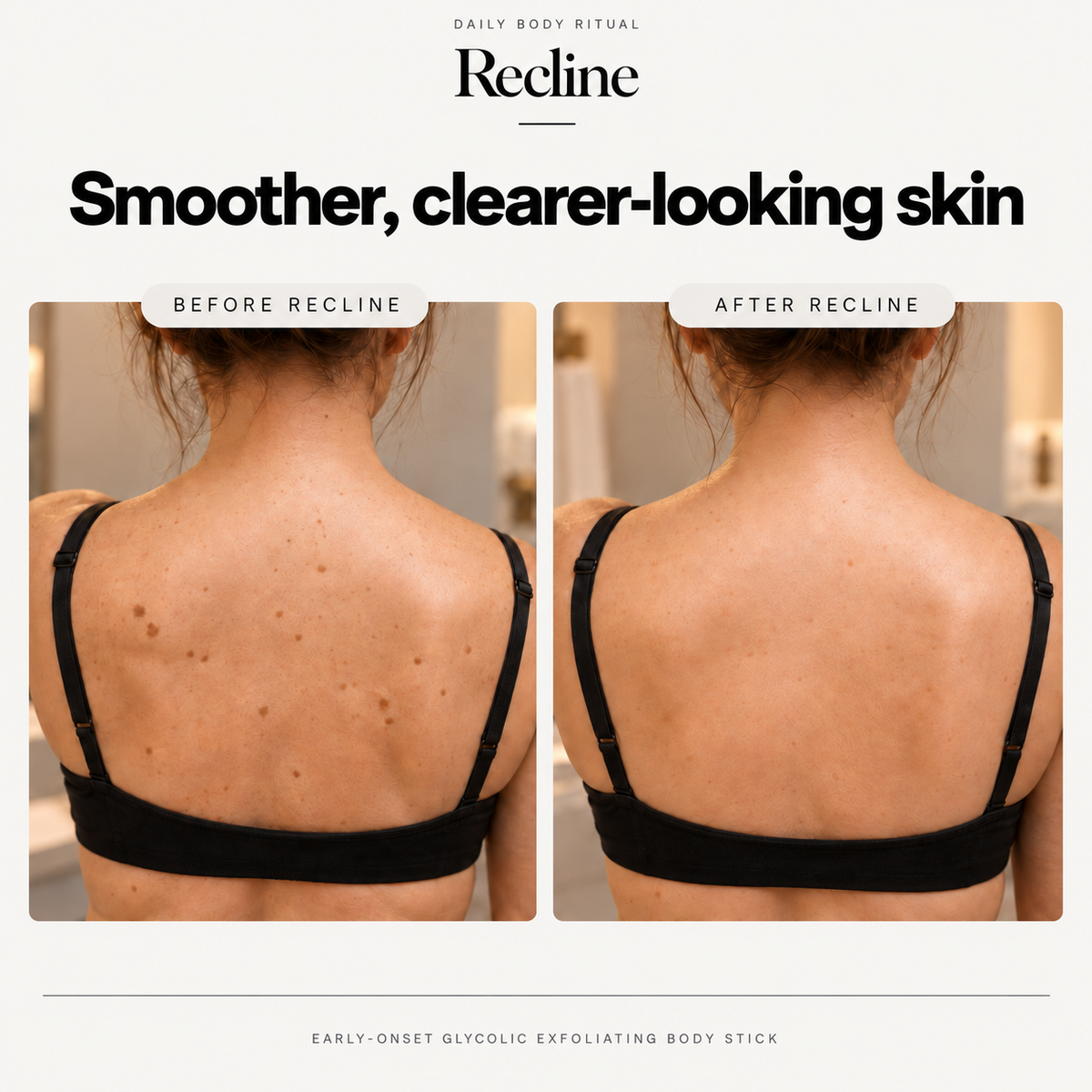 Recline Early-Onset Glycolic Stick