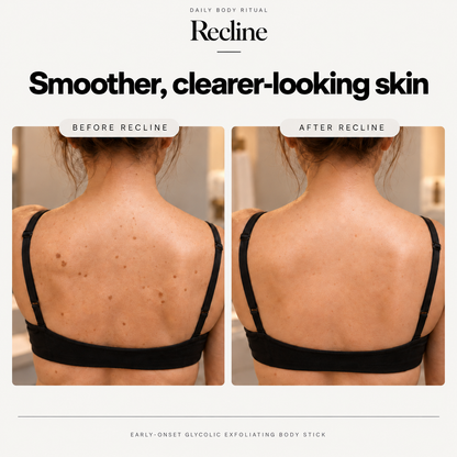 Recline Early-Onset Glycolic Stick
